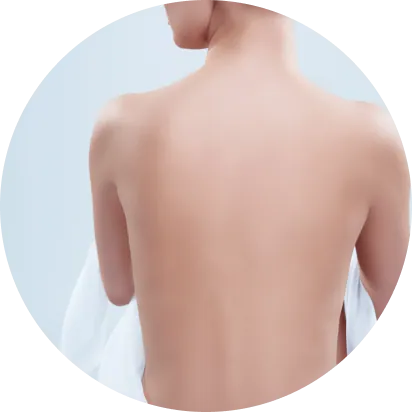 منطقة إزالة الشعر في الجزء الخلفي من الجزء العلوي من الجسم